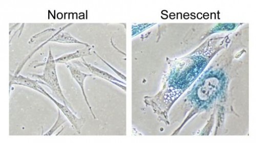 senescence.jpg - senescence.jpg