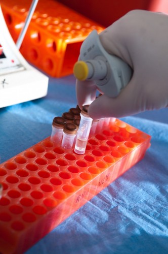 htn1lab_012.jpg