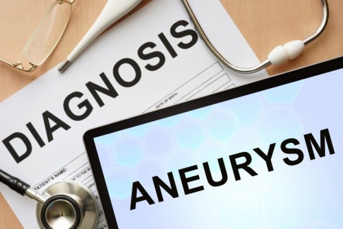 aneurysm photo - aneurysm photo