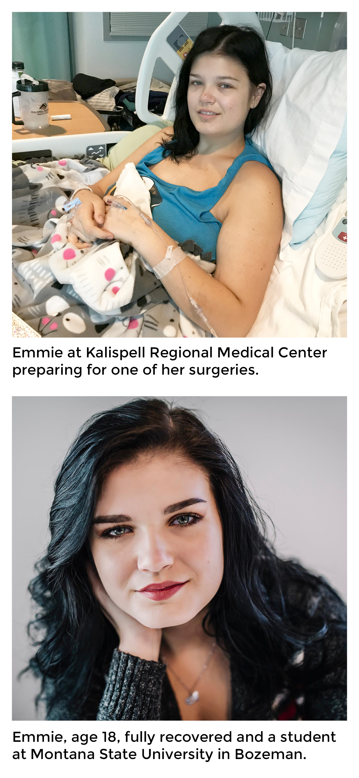inlinephotos_Emmie_before&after