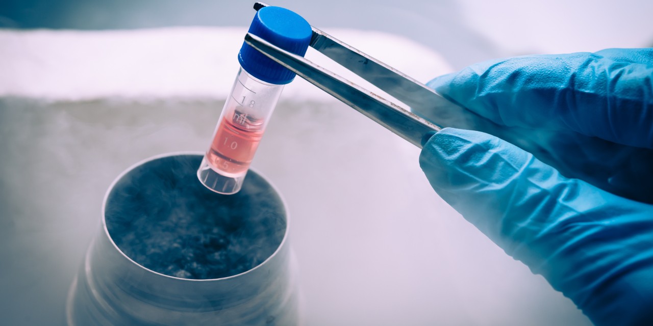 Marketing of unproven stem cell therapies has outpaced legal and regulatory efforts to protect the public from false advertising—and can undermine legitimate stem cell science, argues U of A health law expert Timothy Caulfield. (Photo: Getty Images) Marketing of unproven stem cell therapies has outpaced legal and regulatory efforts to protect the public from false advertising—and can undermine legitimate stem cell science, argues U of A health law expert Timothy Caulfield. (Photo: Getty Images)