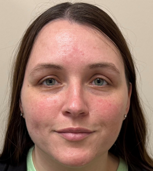 Ashley Brim, OSF HealthCare speech language pathologist