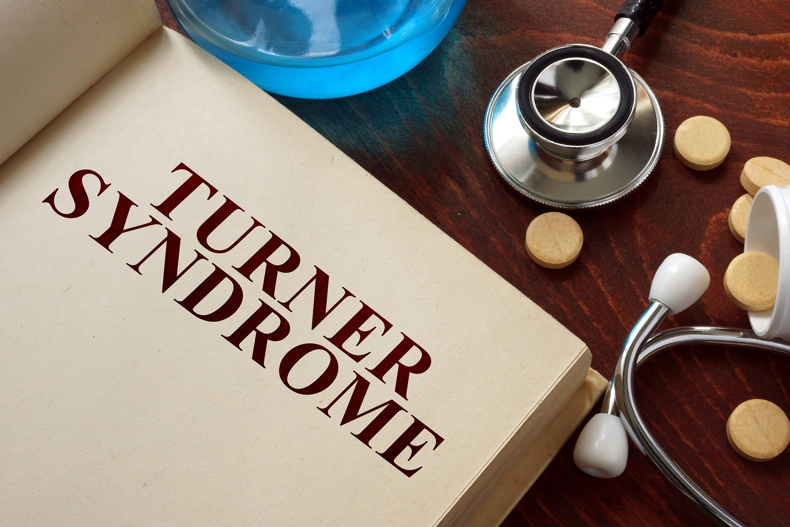 Turner syndrome 4 questions answered