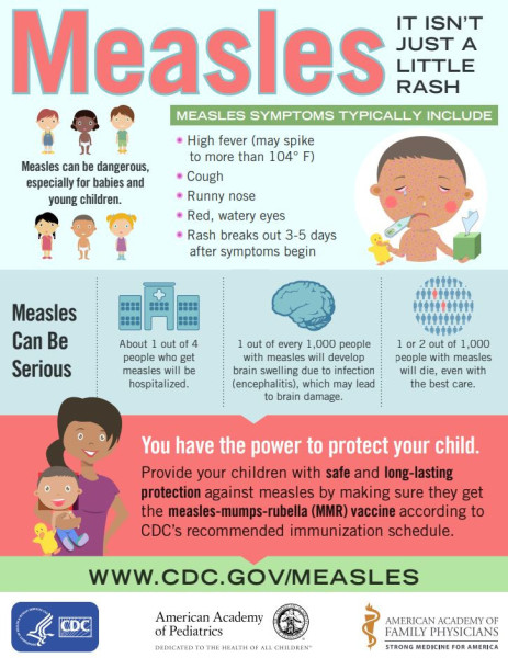 measles fact sheet