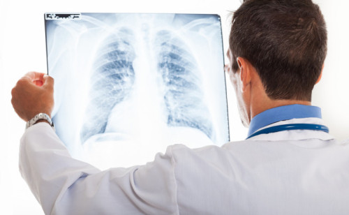 stock-photo-doctor-examining-a-lung-radiography-149486765.jpg