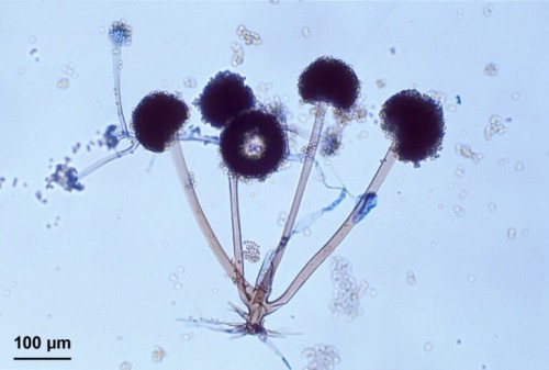 blackfungus.jpg