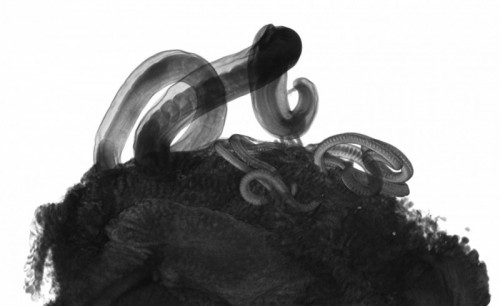 Enormous promise for new parasitic infection treatment