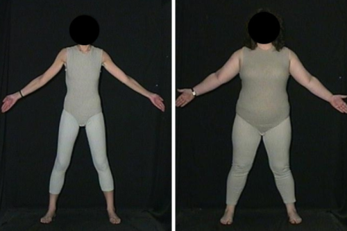 Childhood Shapes Body Image, Say Psychologists | Mirage News