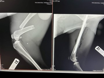 Fracture