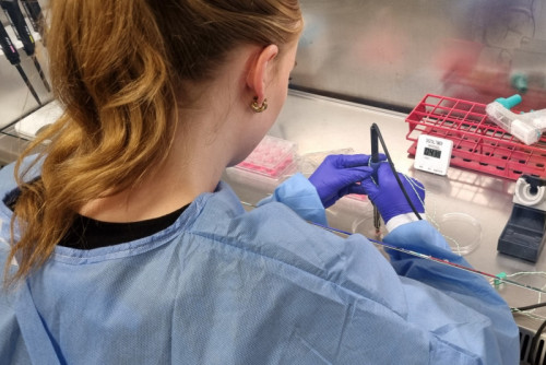 Waarom brandwonden soms langzamer genezen