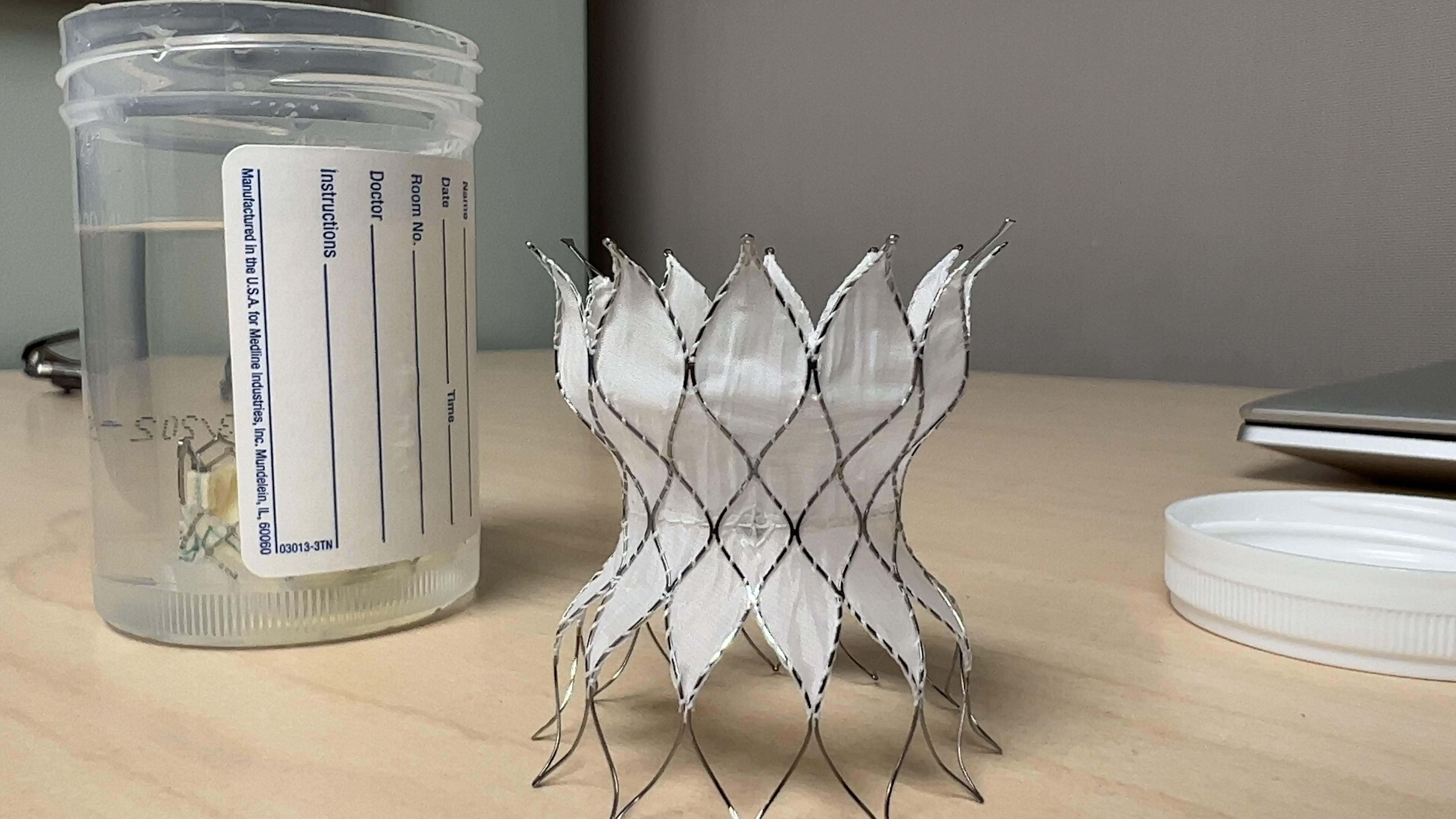 New Pulmonary Valve benefits quality, length of life