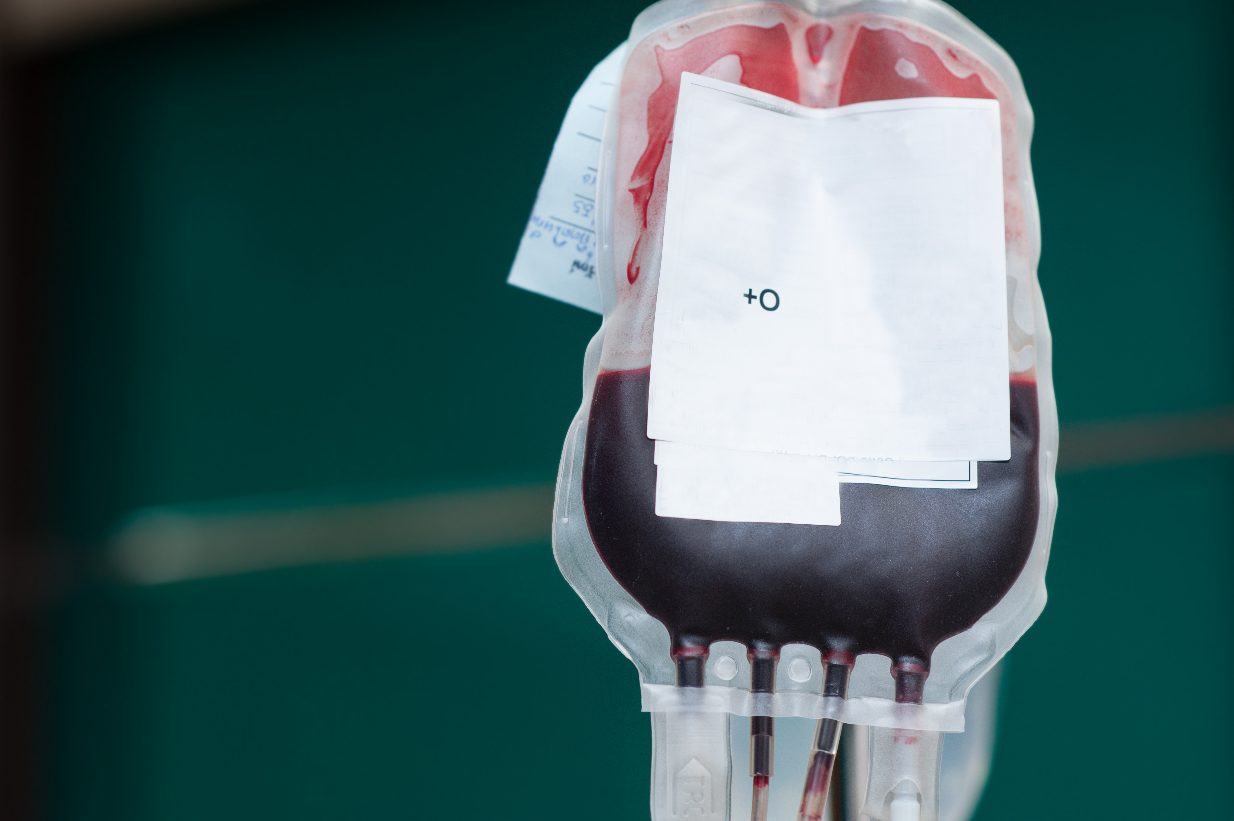 Your Blood Type and the Risk of COVID-19