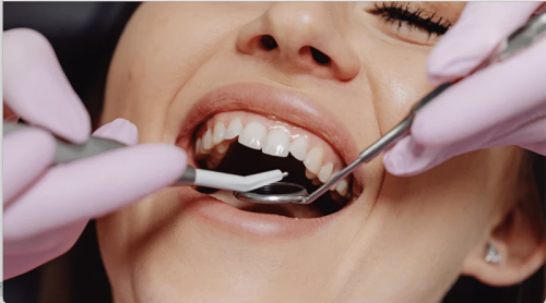 It’s that time, again! Del Mar College Dental Hygiene Program currently offering clinical services “at no cost” image