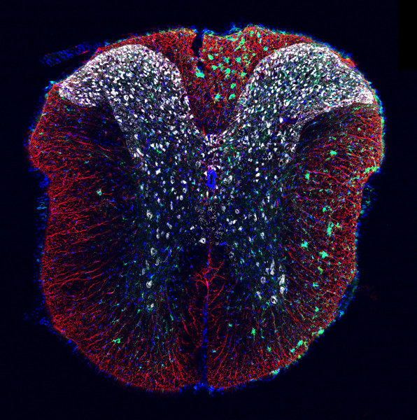 This mouse spinal cord tissue cross section shows lesion-remote astrocytes (LRAs) in red alongside clusters of debris-clearing microglia in green. Photo by Sarah McCallum, PhD, of the Burda Lab at Cedars-Sinai.