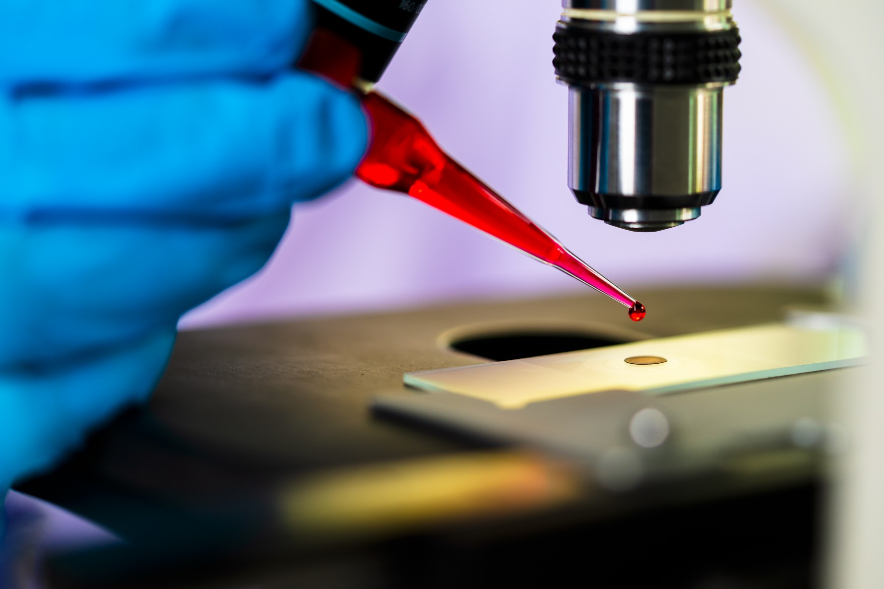 A researcher prepares to study blood cells under a microscope. Photo by Getty.