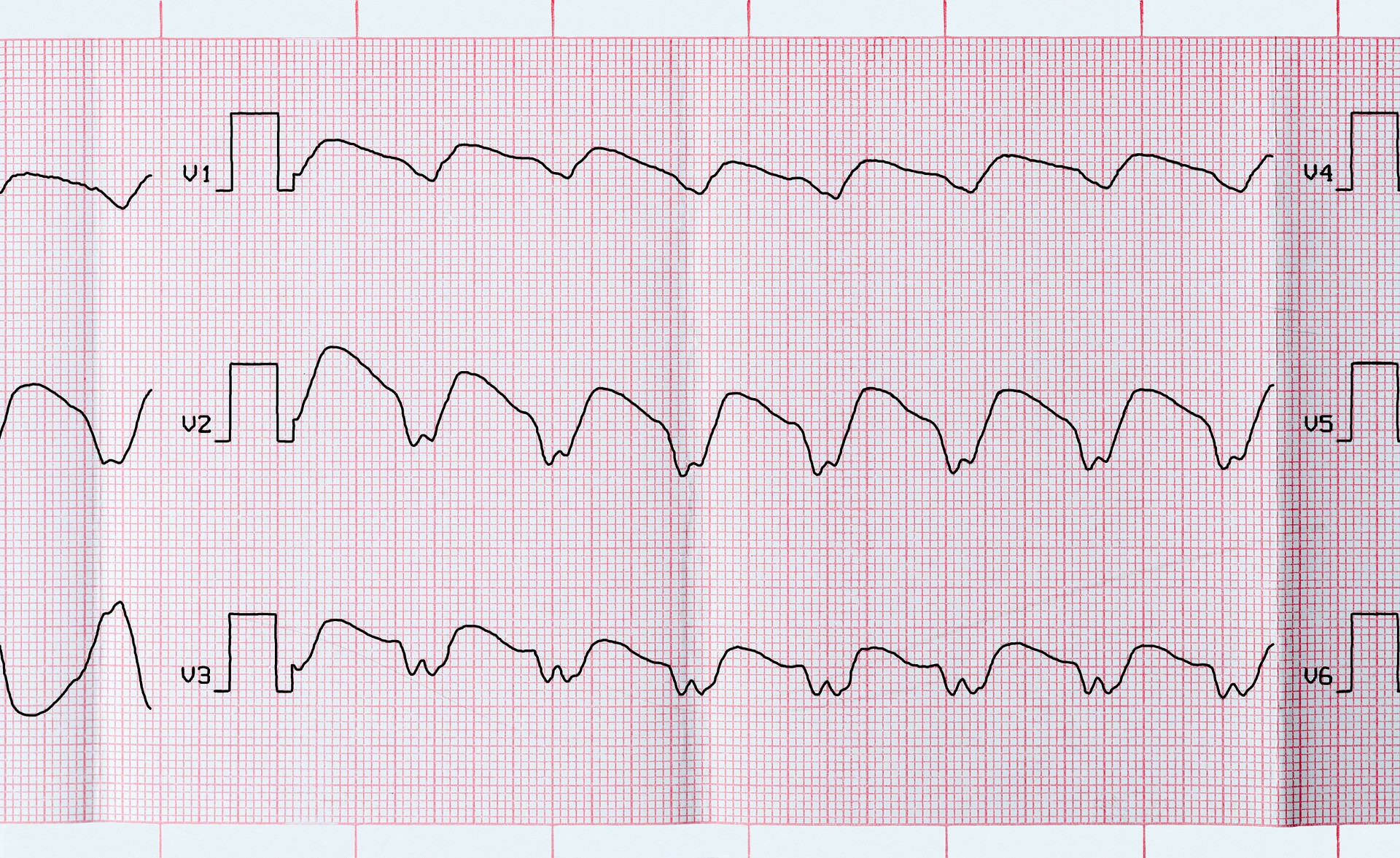 Heart rate versus heart rhythm