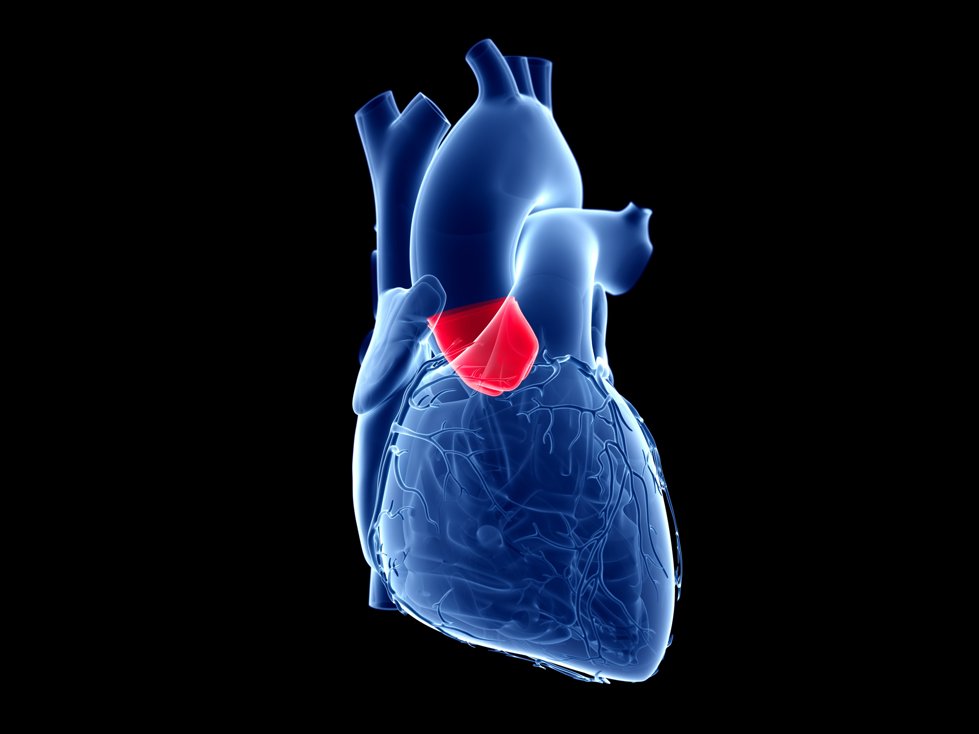 NEJM Study Supports Minimally Invasive Procedure for Aortic Stenosis