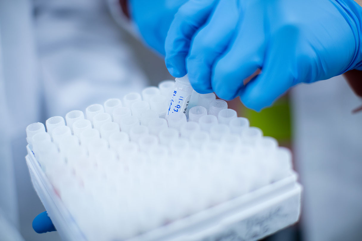 Cedars-Sinai’s Biobank and Research Pathology Resource has earned reaccreditation in four areas from the College of American Pathologists. Photo by Cedars-Sinai.