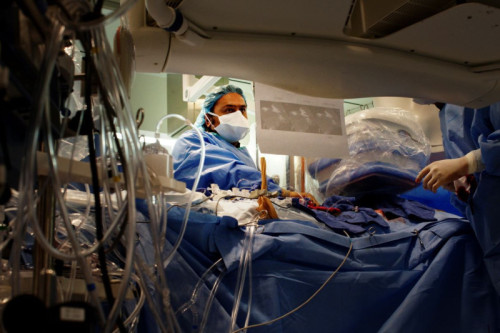 Minimally Invasive Heart Surgery - Los Angeles, CA | Cedars