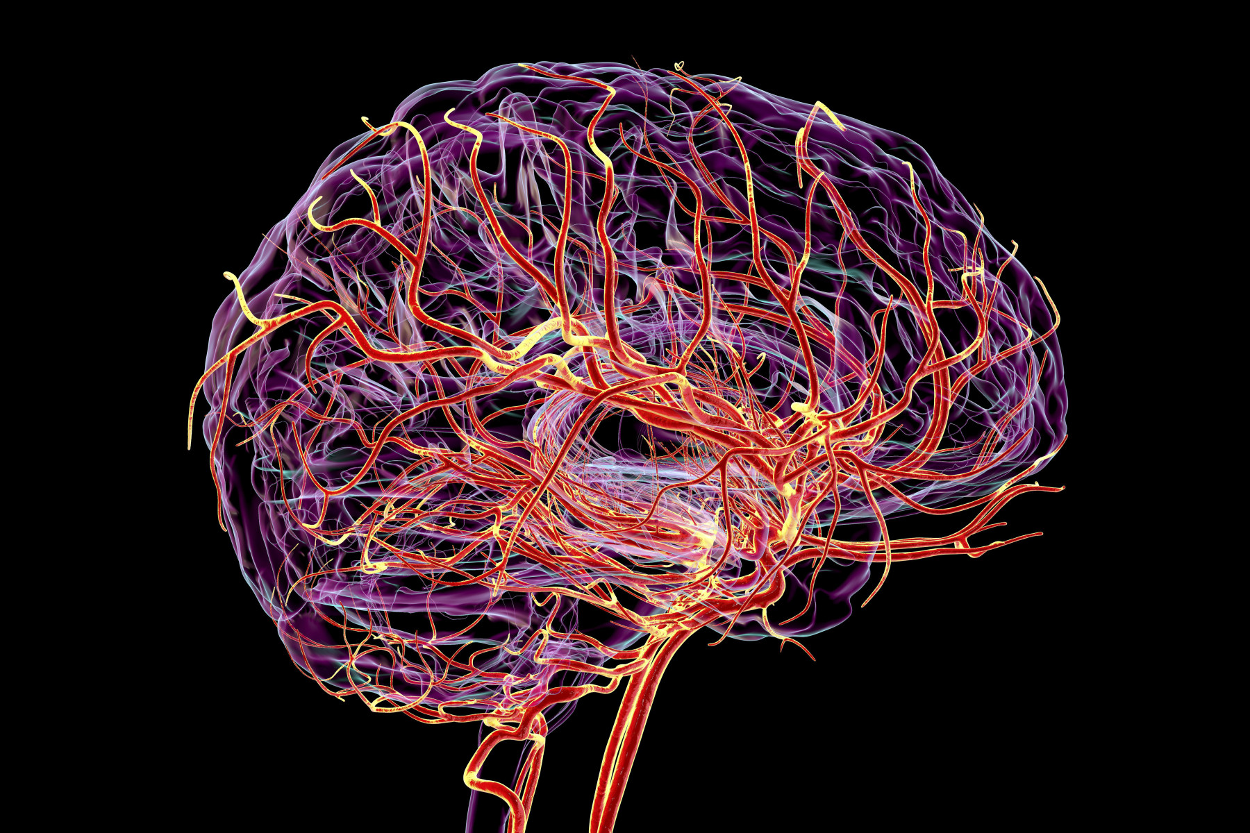 Cedars-Sinai Experts Attend International Stroke Conference