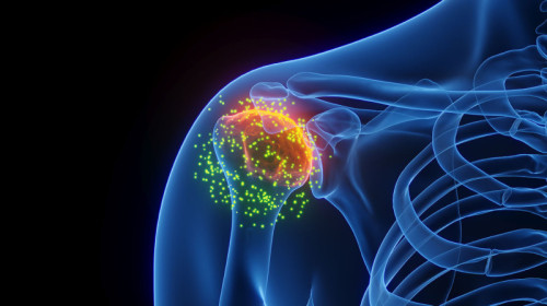Rheumatology - Los Angeles, CA | Cedars-Sinai