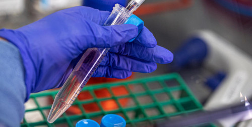image-Alzheimer’s Disease: The Complexities of Clinical Trials