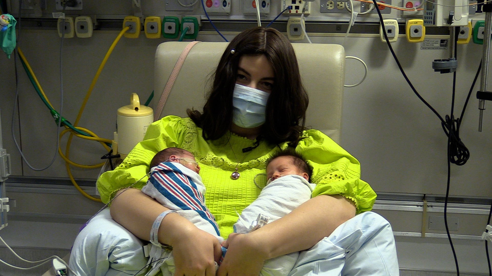 Twin Baby Boom Seeing Double in the Neonatal Intensive Care Unit