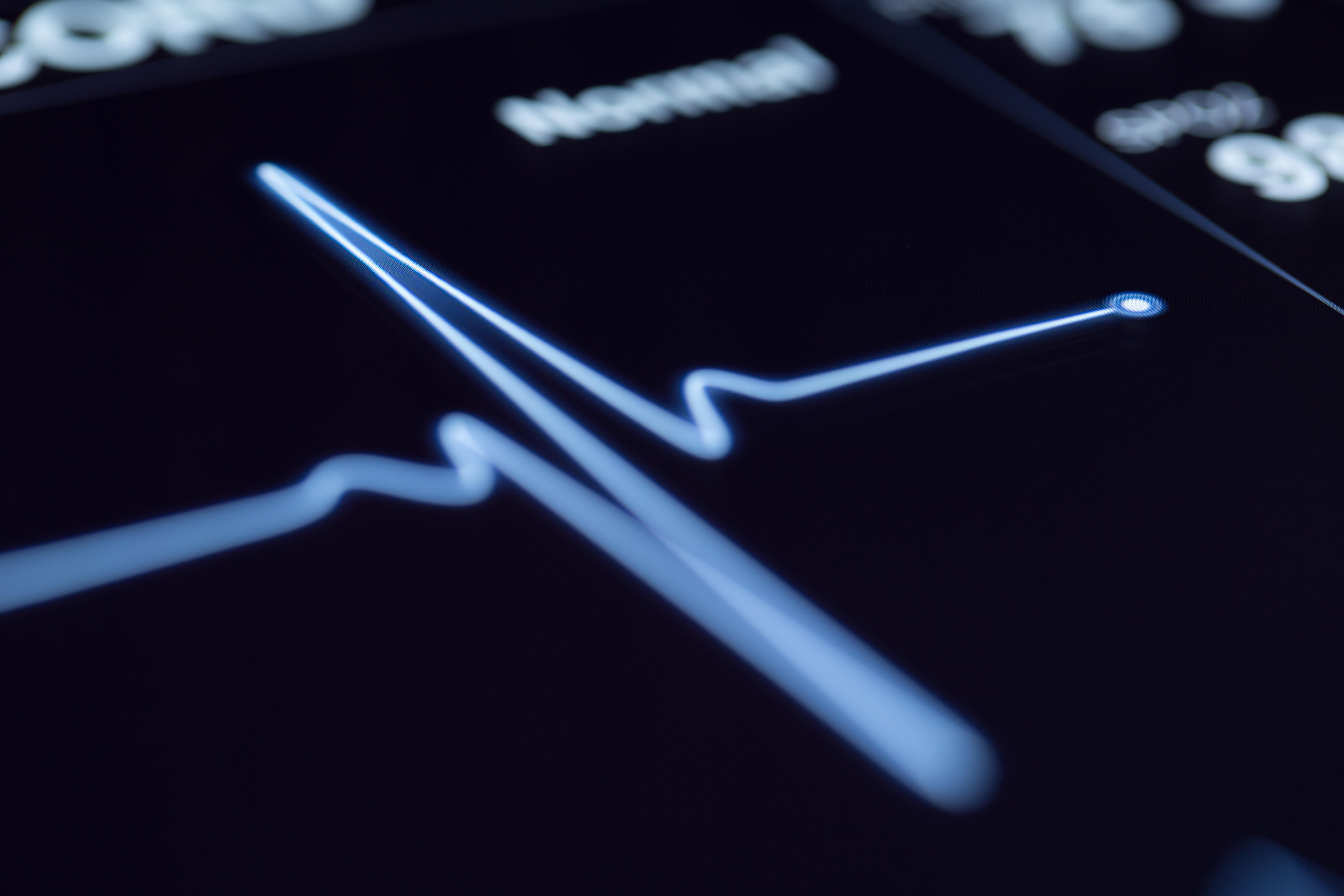 Patients With Common Heart Failure More Likely to Have Lethal Heart Rhythms