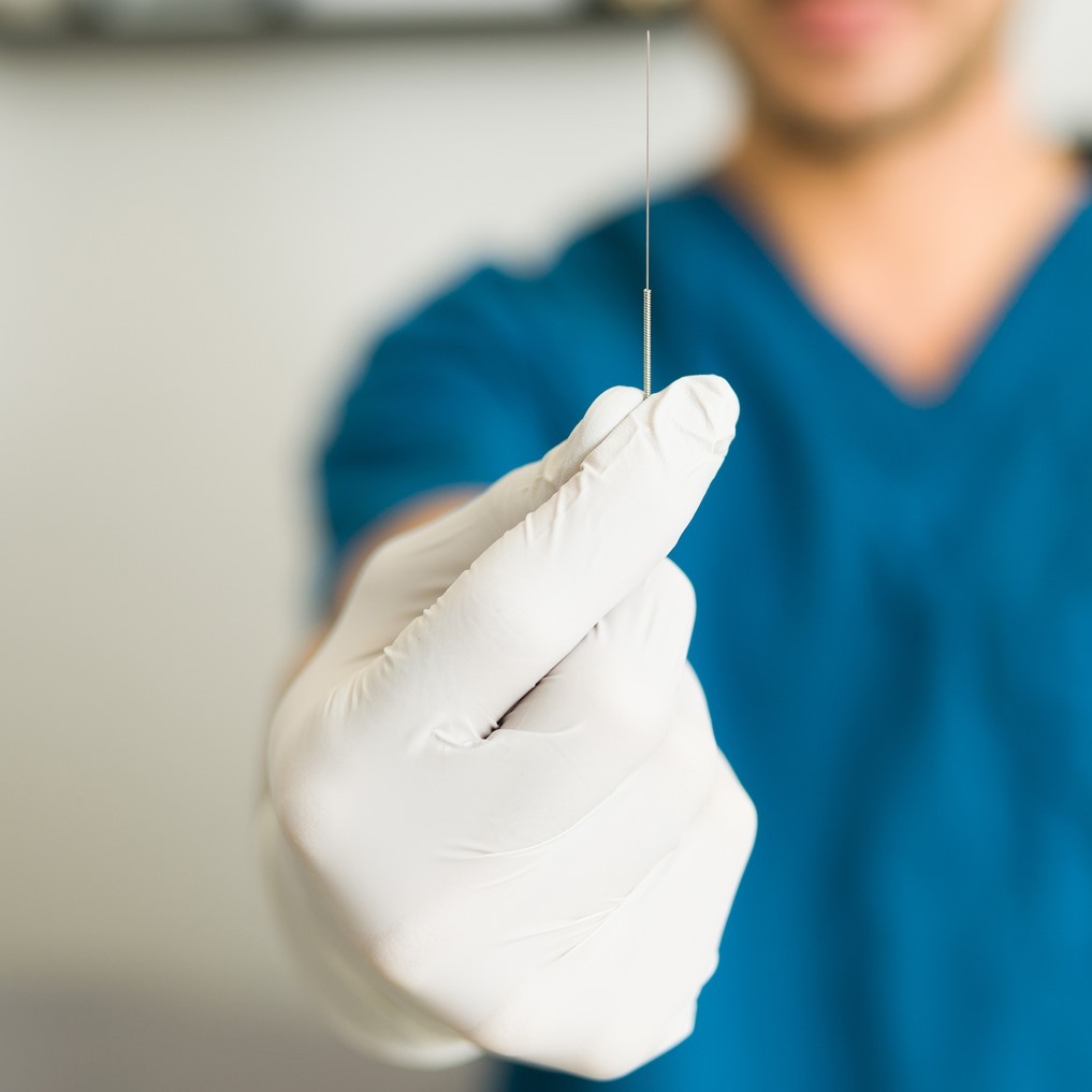 Acupuncture reduces pain and opioid usage for total knee replacement