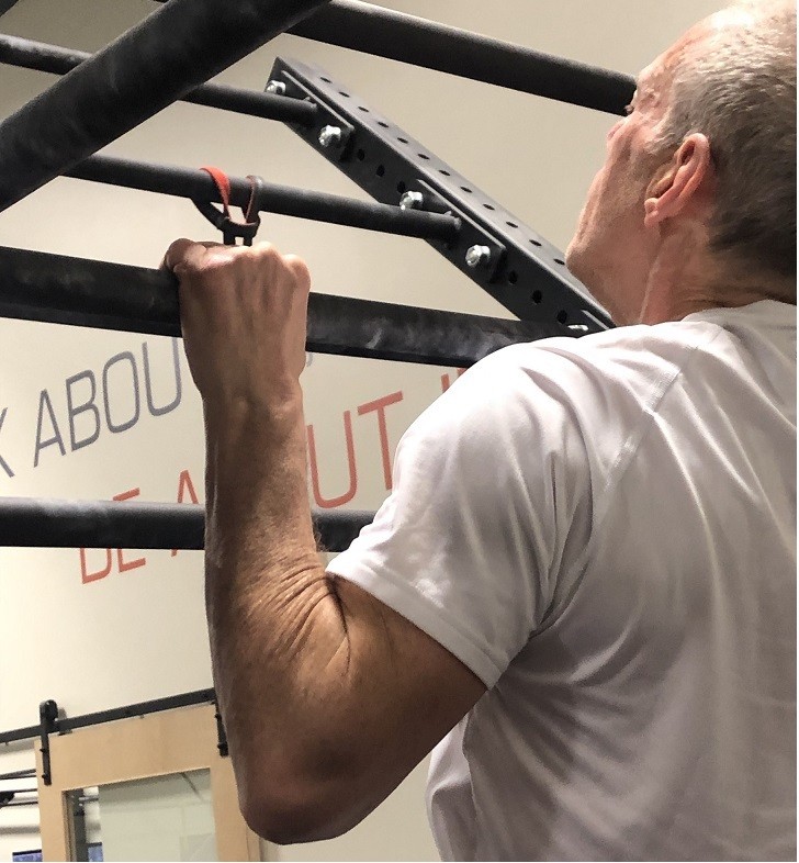 Novel Surgery Restores Function of Common Wrist Injury