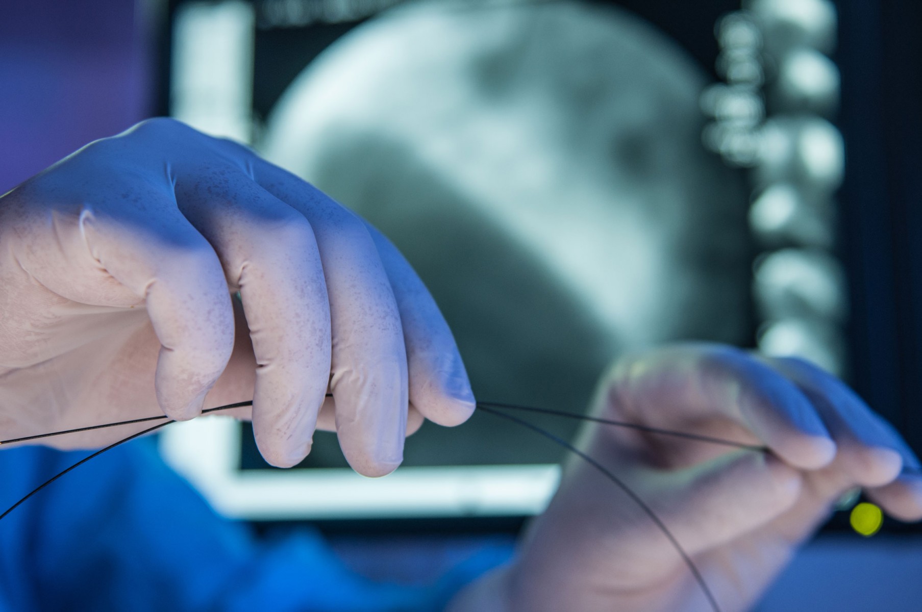 Stent Engineering Smarter Stents