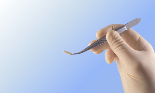 Pitt-Founded Startup Achieves First-in-Human Implant of Nerve Pain Device