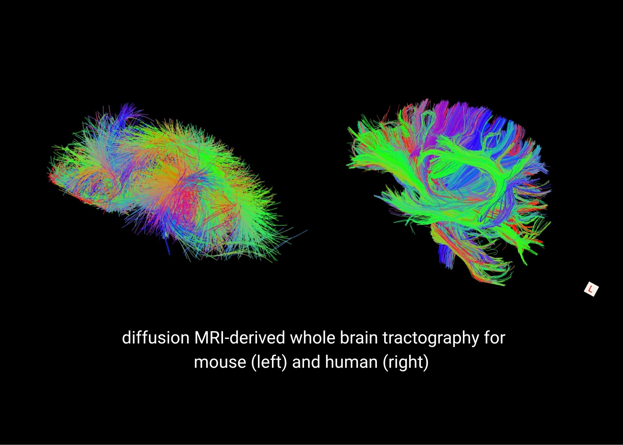 The brain’s power could also help predict its decline