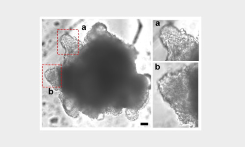 Heart assembloids give researchers a new way to study heart valve disorders