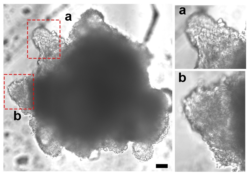 心臓弁疾患を研究する新しいモデル「心臓アッセンブロイド」を開発（Heart assembloids give researchers a new way to study heart valve disorders）