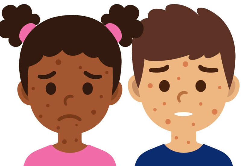 measles signage