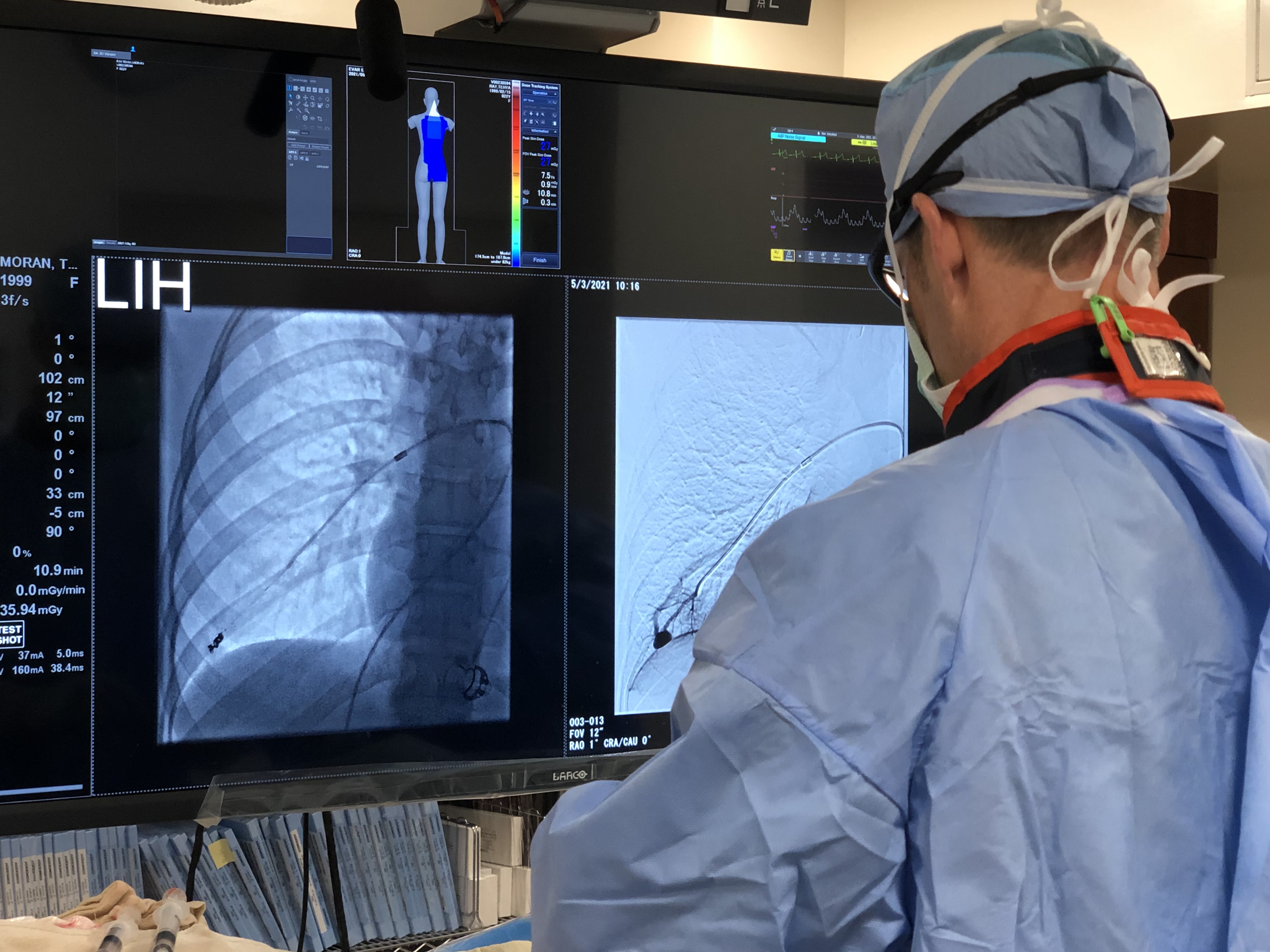 IR Procedure Photo