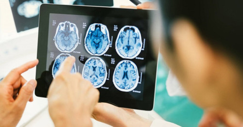 Bayer first company to advance cell therapy as well as gene therapy against Parkinson’s disease