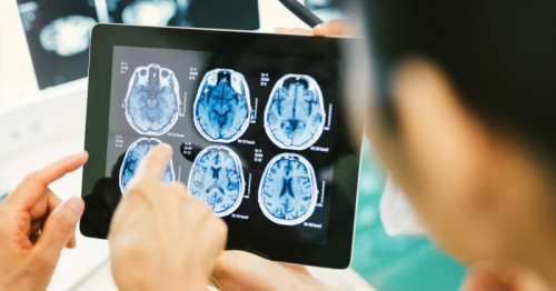 BlueRock Therapeutics reports positive 36-month results from Phase I trial of bemdaneprocel for treating Parkinson’s disease